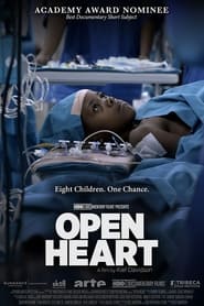 Open Heart Open Heart