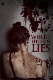 Where the Skin Lies Where the Skin Lies